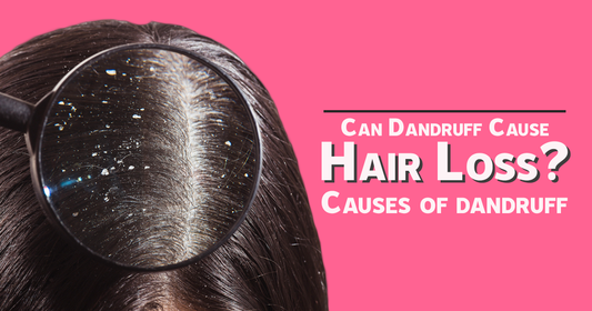 Can Dandruff Cause Hair Loss? Causes of dandruff